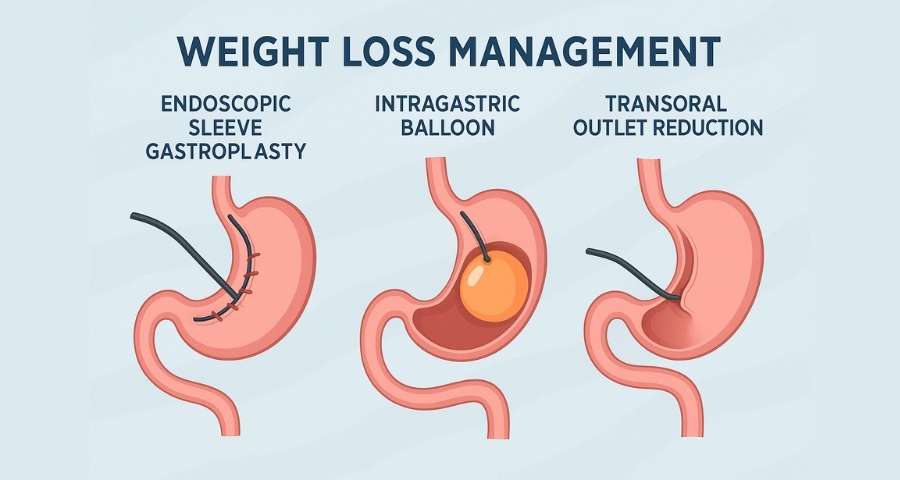 weight loss treatments in Gurgaon
