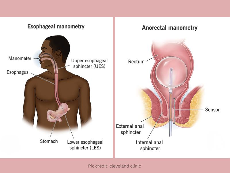 manometry in Gurgaon