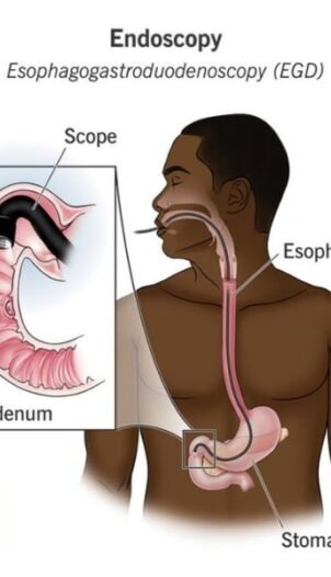 endoscopy in Gurgaon