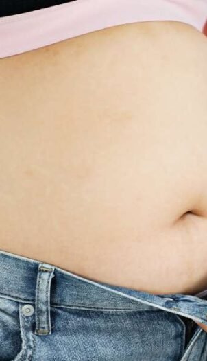 weight loss treatment in Gurgaon