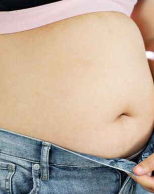 weight loss treatment in Gurgaon