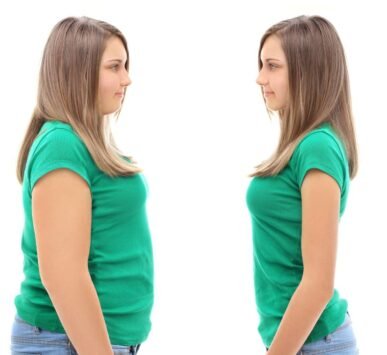 weight loss treatment in Gurgaon