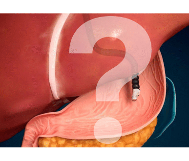 important questions about EUS