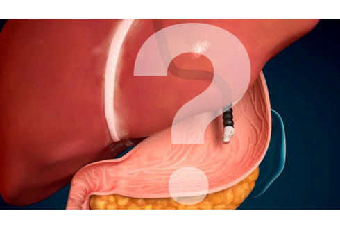 important questions about EUS