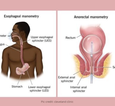 menometry in Gurgaon