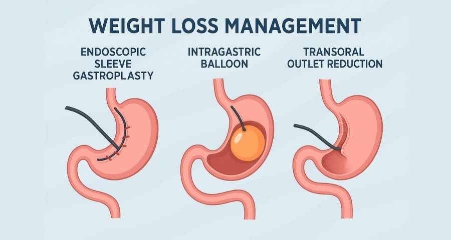 Weight loss treatments in Gurgaon