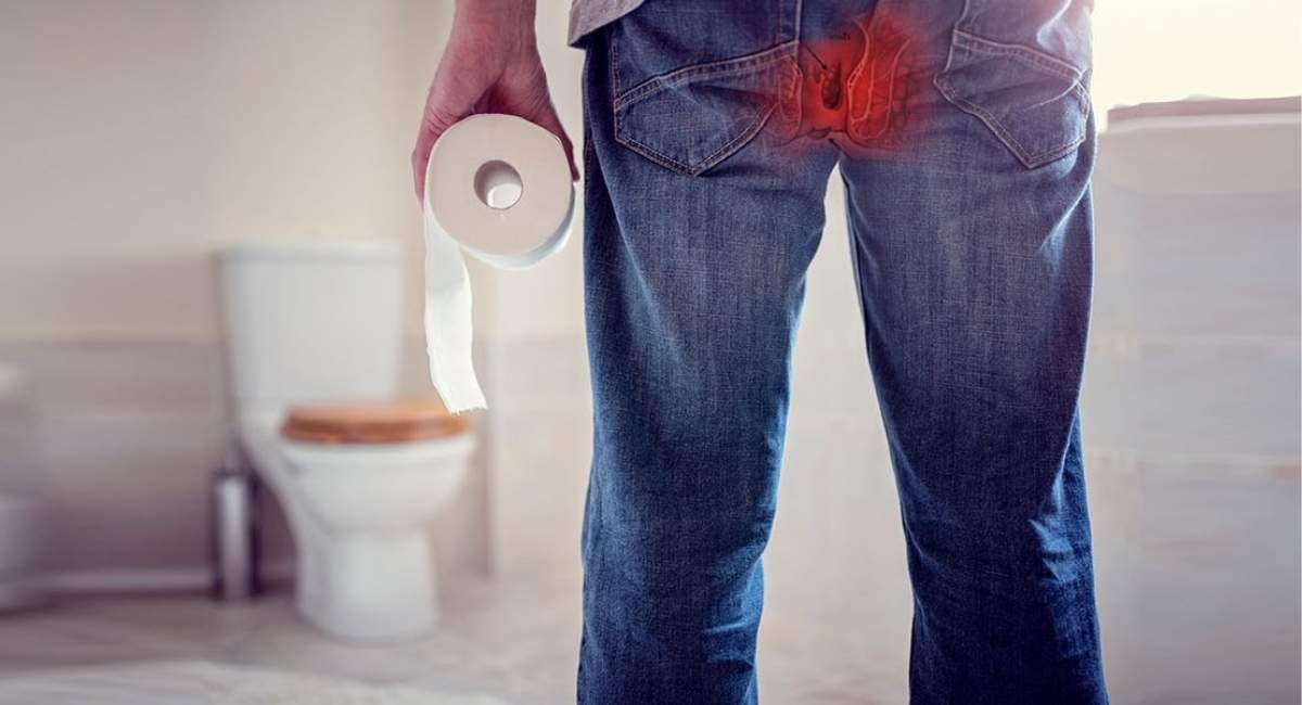 piles treatment gurugram