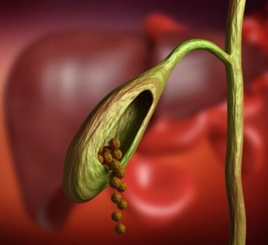 gallbladder stone removal surgery Gurgaon