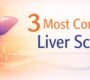 3 most common liver scans 90x80