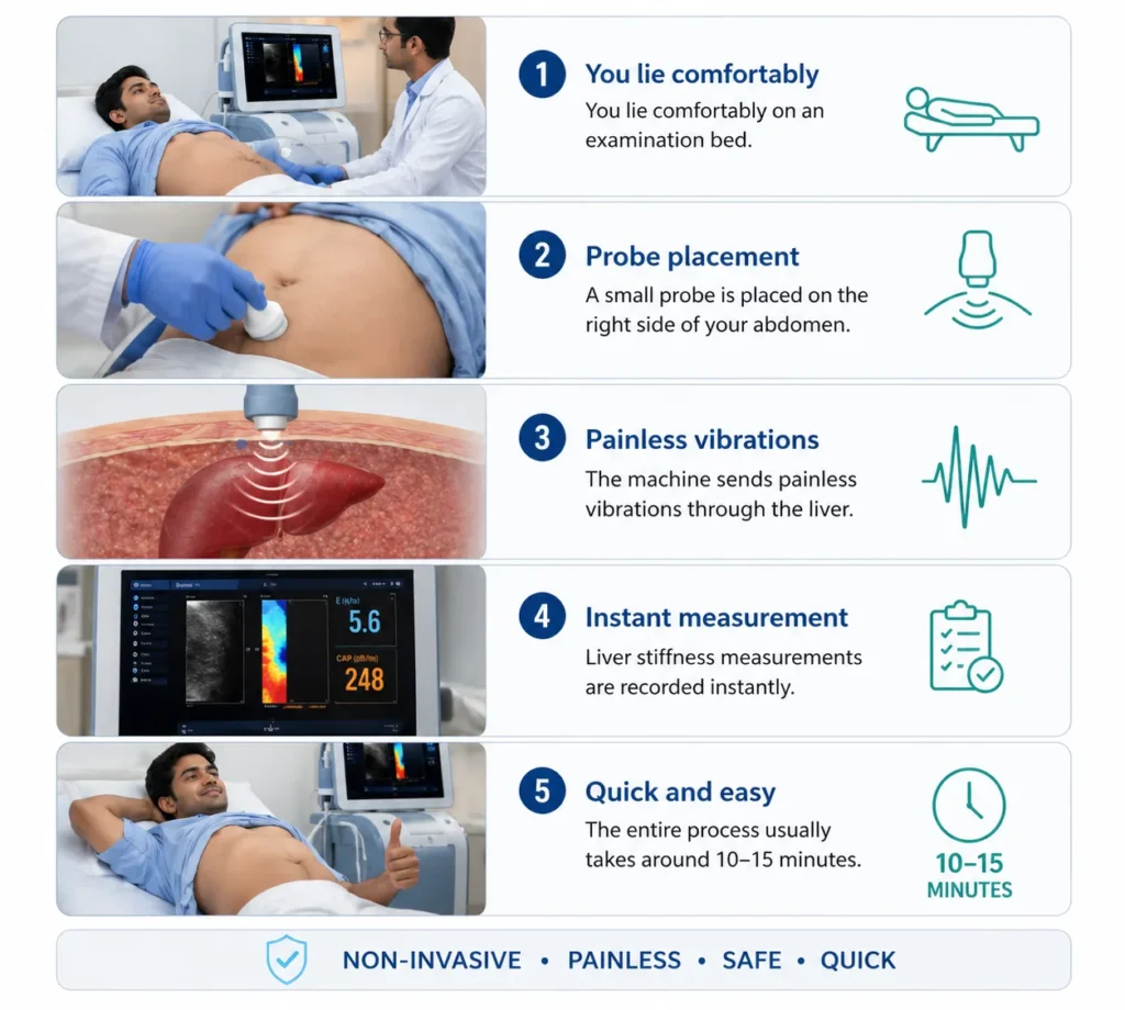 fibroscan procedure